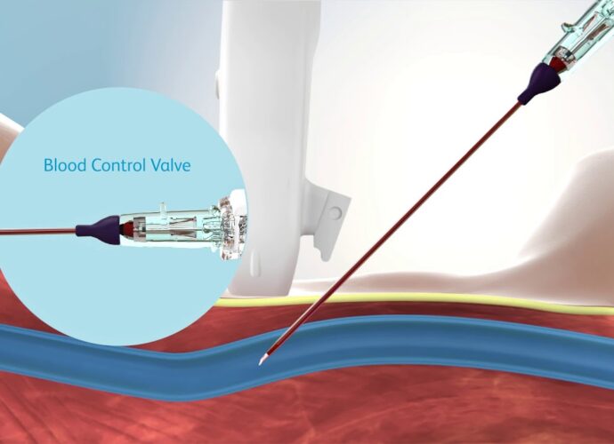 Global Intravascular Catheters Market